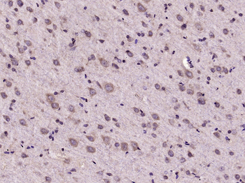 IL17D Rabbit Polyclonal Antibody
