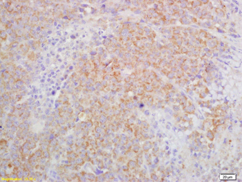 IL27R Rabbit Polyclonal Antibody