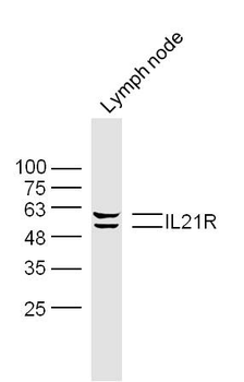 IL21R Rabbit Polyclonal Antibody