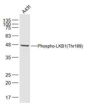 Phospho-LKB1 (Thr189) Rabbit Polyclonal Antibody