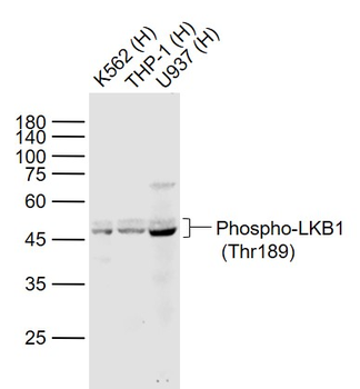 Phospho-LKB1 (Thr189) Rabbit Polyclonal Antibody