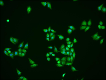 Lamin B Receptor Rabbit Polyclonal Antibody