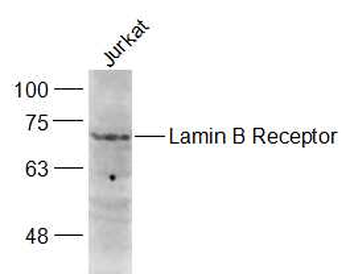 Lamin B Receptor Rabbit Polyclonal Antibody