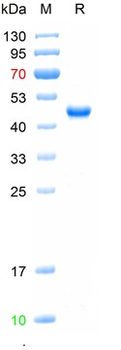 Recombinant human AD7c-NTP protein, His