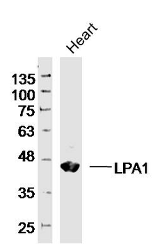 LPA1 Rabbit Polyclonal Antibody