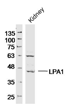 LPA1 Rabbit Polyclonal Antibody
