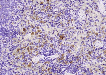 MD1 Rabbit Polyclonal Antibody