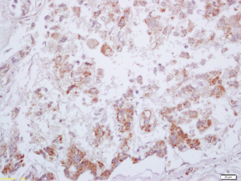 Phospho-PKM2 (Tyr105) Rabbit Polyclonal Antibody