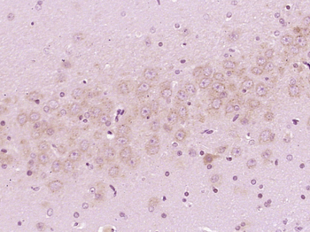 Phospho-MARCKS (Ser152 + Ser156) Rabbit Polyclonal Antibody