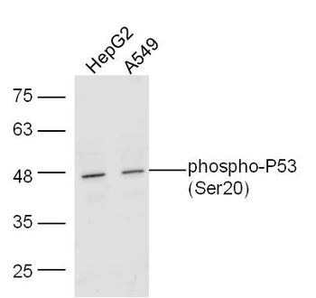 Phospho-P53 (Ser20) Rabbit Polyclonal Antibody