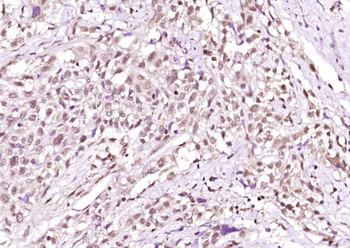 Phospho-PKA alpha + beta (Thr198) Rabbit Polyclonal Antibody