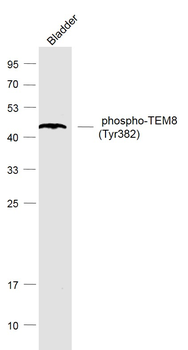 Phospho-TEM8 (Tyr382) Rabbit Polyclonal Antibody