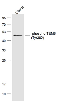 Phospho-TEM8 (Tyr382) Rabbit Polyclonal Antibody