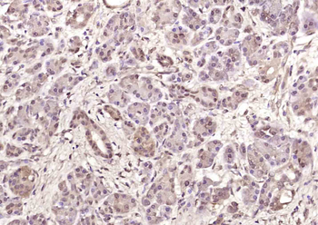 Phospho-MAPKAPK5 (Ser93) Rabbit Polyclonal Antibody