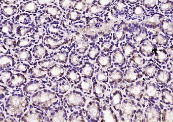 Phospho-MAPKAPK5 (Ser93) Rabbit Polyclonal Antibody