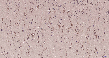 Phospho-MAPKAPK5 (Ser93) Rabbit Polyclonal Antibody