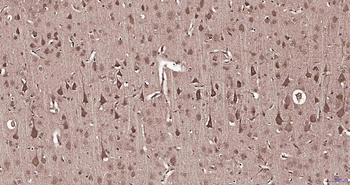 Phospho-MAPKAPK5 (Ser93) Rabbit Polyclonal Antibody