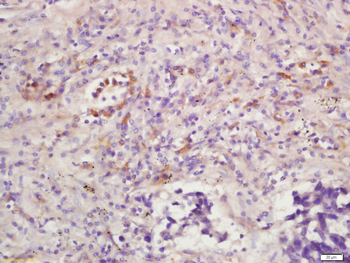 Phospho-MAPKAPK5 (Ser93) Rabbit Polyclonal Antibody