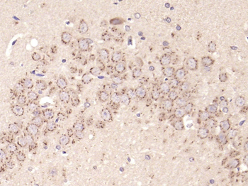 Phospho-Tuberin (Thr1462) Rabbit Polyclonal Antibody