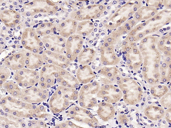 Phospho-Tuberin (Thr1462) Rabbit Polyclonal Antibody