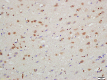 TXNIP Rabbit Polyclonal Antibody