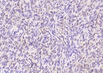 NR2F1/NR2F2 Rabbit Polyclonal Antibody