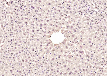 NR2F1/NR2F2 Rabbit Polyclonal Antibody