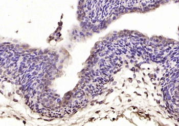 NR2F1/NR2F2 Rabbit Polyclonal Antibody