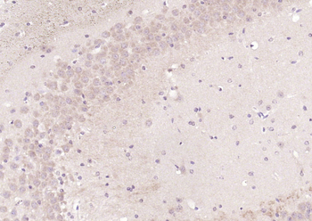 CTNND2/delta 2 Catenin Rabbit Polyclonal Antibody