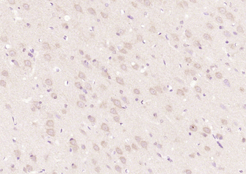 CTNND2/delta 2 Catenin Rabbit Polyclonal Antibody