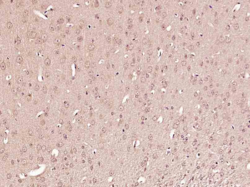Phospho-Tuberin (Ser1418) Rabbit Polyclonal Antibody