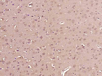 Phospho-Tuberin (Ser1418) Rabbit Polyclonal Antibody