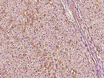 Phospho-Tuberin (Ser1418) Rabbit Polyclonal Antibody