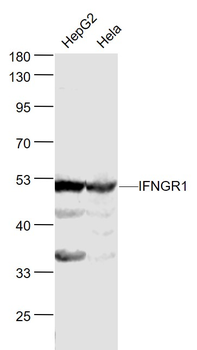 IFNGR1 Rabbit Polyclonal Antibody