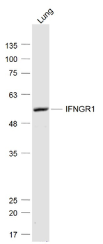 IFNGR1 Rabbit Polyclonal Antibody