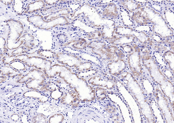 LPA1 Rabbit Polyclonal Antibody