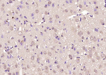 MeCP2 Rabbit Polyclonal Antibody