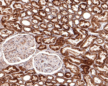 BCL2A1 Recombinant Rabbit Monoclonal Antibody