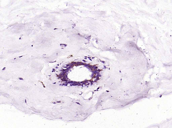 Bad Recombinant Rabbit Monoclonal Antibody