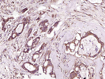 Bad Recombinant Rabbit Monoclonal Antibody