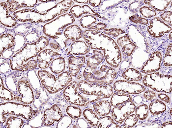 Bad Recombinant Rabbit Monoclonal Antibody