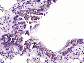 Bad Recombinant Rabbit Monoclonal Antibody