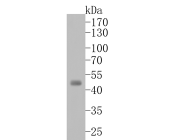Aurora A Recombinant Rabbit Monoclonal Antibody