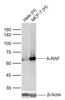 A-RAF Recombinant Rabbit Monoclonal Antibody