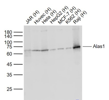 Alas1 (1G11) Recombinant Rabbit Monoclonal Antibody