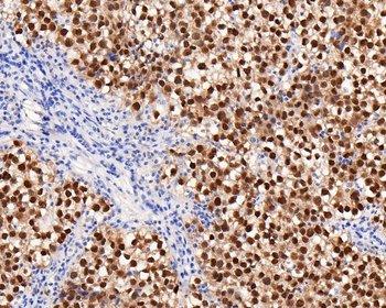 Oct4 Recombinant Rabbit Monoclonal Antibody