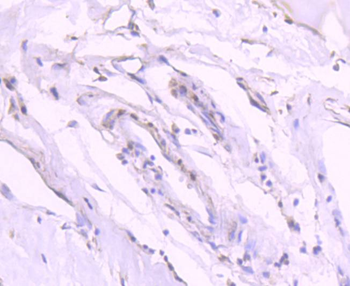 Phospho-GATA3 (Ser308) Recombinant Rabbit Monoclonal Antibody