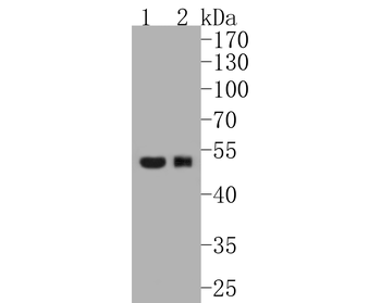 Phospho-GATA3 (Ser308) Recombinant Rabbit Monoclonal Antibody