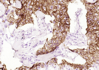 Cytokeratin 5 Recombinant Rabbit Monoclonal Antibody