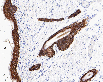 Cytokeratin 5 Recombinant Rabbit Monoclonal Antibody